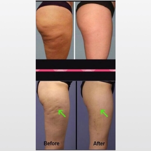 Time-wise Cellulite Body Cream Gel Female Beauty - Picture 8 of 9